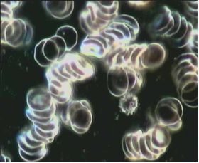 Blutprobe ohne - Amanda Energieprodukte: Bluttest mit Dunkelfeldmikroskopie - Amanda Energieprodukte, Amulett, Bodenbelebung, Depression, Der richtige Platz, dowsing, earth rays, electromagnetic stress, Elektrosmog, Energiesysteme,Energietechnik,energy products, entst�ren, Entst�rung, Erdstrahlen, Erdstrahlung, Ersch�pfung, fatigue, Feng Shui, Geomantie, geopathic stress, Hautkrankheit, Hautproblem, Hyperaktivit�t, insomnia, Kinderlosigkeit, Kopfschmerzen, Kraftort, Kraftplatz, Lichtenergie, Medaillon, Migr�ne, M�digkeit, Nervosit�t, Neurodermitis, Orgon, Ort der Kraft, Pendel, pendeln, place of power, Psoriasis, pyramid, Pyramide, Radi�sthesie, Resonanz-Technologie, R�ckenschmerzen, Rute, Rutengehen, Schlaflosigkeit, Schlafplatzuntersuch, Schlafst�rungen, Schmerzen, Standortbelastung, Stoffwechselst�rungen, Tachionen, Tachyon, Tschopp, Umweltverschmutzung, Unterleibsbeschwerden, Verdauungsproblem, Verspannungen, vitalisation, vitaliser, vitalisieren, Wasser, Wasserader, Wasseradern, Wasseraktivierung, Wasserbelebung, Wasserqualit�t, Wassertherapie, Wasservitalisierung, water, W�nschelrute, LIEBE, DANKBARKEIT
